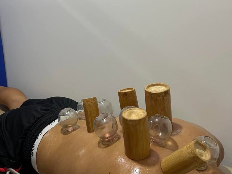 Ventouses traditionnelles en bambou lors d'une séance de hijama