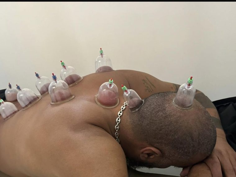 Patient pendant une séance de hijama au cabinet